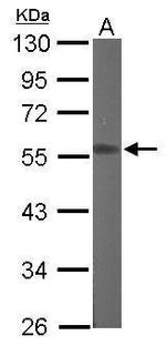 RGMB Antibody in Western Blot (WB)