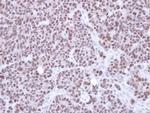 NSMCE1 Polyclonal Antibody