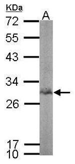 Bisphosphoglycerate mutase Antibody in Western Blot (WB)
