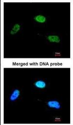 ZNF398 Polyclonal Antibody