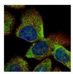 VTA1 Polyclonal Antibody