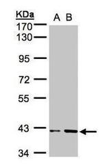 PRPSAP1 Antibody in Western Blot (WB)