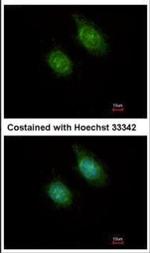 CAMK1D Polyclonal Antibody