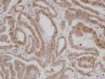 CAMK1D Antibody in Immunohistochemistry (Paraffin) (IHC (P))