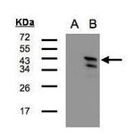 CAMK1D Antibody in Western Blot (WB)