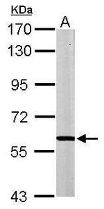 MPP2 Polyclonal Antibody