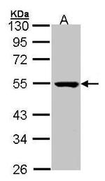 PSKH1 Antibody in Western Blot (WB)