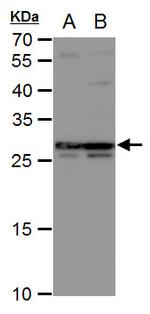 DCK Antibody in Western Blot (WB)