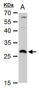 DCK Antibody in Western Blot (WB)