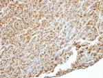 PIK3R4 Antibody in Immunohistochemistry (Paraffin) (IHC (P))
