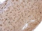PIK3R4 Antibody in Immunohistochemistry (Paraffin) (IHC (P))