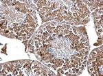 PIK3R4 Antibody in Immunohistochemistry (Paraffin) (IHC (P))