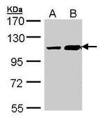 TRAK2 Polyclonal Antibody