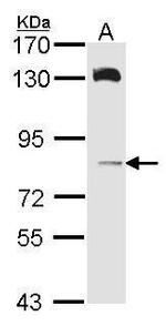 HPS6 Polyclonal Antibody