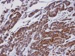 ORP1 Antibody in Immunohistochemistry (Paraffin) (IHC (P))