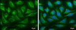 ORP6 Polyclonal Antibody