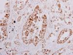ORP6 Antibody in Immunohistochemistry (Paraffin) (IHC (P))