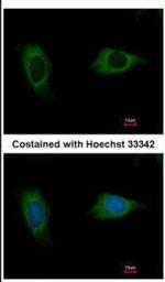 EVC2 Polyclonal Antibody