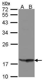 RARRES3 Polyclonal Antibody