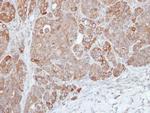 HPS3 Antibody in Immunohistochemistry (Paraffin) (IHC (P))