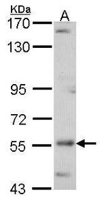 ADCK4 Polyclonal Antibody