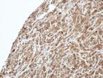 PI3K p55 gamma Polyclonal Antibody