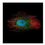 LIMK2 Polyclonal Antibody