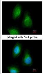 SEPHS2 Polyclonal Antibody