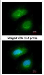PRAK Polyclonal Antibody