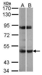 PRAK Antibody in Western Blot (WB)