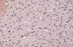 NUP62 Antibody in Immunohistochemistry (Paraffin) (IHC (P))
