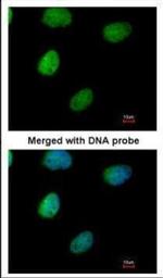 ITPK1 Polyclonal Antibody