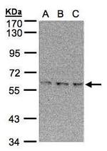 EPM2AIP1 Polyclonal Antibody