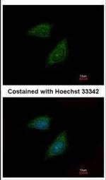 PI15 Polyclonal Antibody