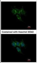 GSTA1 Polyclonal Antibody