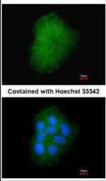 TMEM147 Polyclonal Antibody