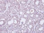 TMEM147 Antibody in Immunohistochemistry (Paraffin) (IHC (P))