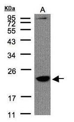 TMEM147 Antibody in Western Blot (WB)