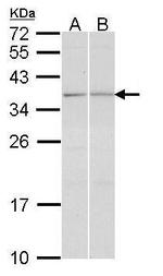 TGIF2 Polyclonal Antibody