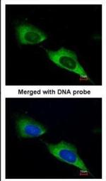 MTMR9 Polyclonal Antibody