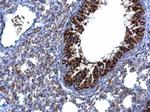 MTMR9 Antibody in Immunohistochemistry (Paraffin) (IHC (P))