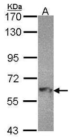 MTMR9 Antibody in Western Blot (WB)