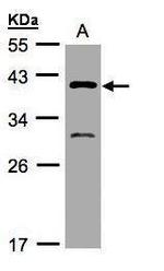GIPC3 Polyclonal Antibody