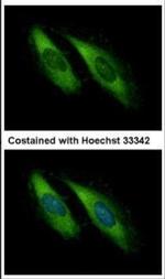 Munc13-4 Polyclonal Antibody