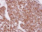 XPR1 Polyclonal Antibody