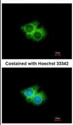 GPR62 Antibody in Immunocytochemistry (ICC/IF)