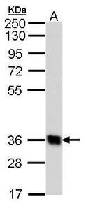 GPR62 Antibody in Western Blot (WB)