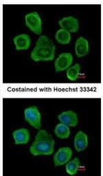 PTGFRN Polyclonal Antibody
