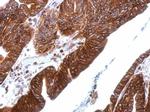 Thrombomodulin Antibody in Immunohistochemistry (Paraffin) (IHC (P))