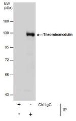 Thrombomodulin Antibody in Immunoprecipitation (IP)
